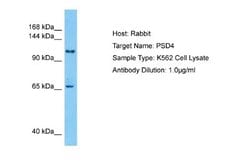 PSD4 Antibody, Novus Biologicals 100 &mu;L; Unconjugated:Antibodies, Polyclonal